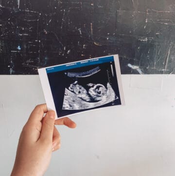 A Little Cupcake Ultrasound held in hand in front of white and black painting