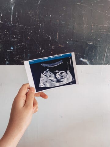 A Little Cupcake Ultrasound held in hand in front of white and black painting